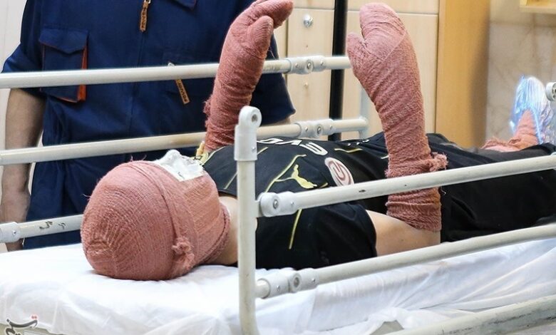 جزئیات تعهدات بیمه سلامت در حوزه سوختگی