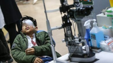 181 مصدوم و 6 فوتی در حوادث چهارشنبه سوری/ 74 درصد مصدومان سن زیر 18 سال دارند