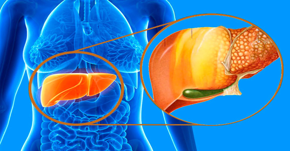با علائم کبد چرب + راه حل درمانی در طب سنتی آشنا شوید