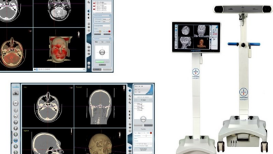 استفاده 120 بیمارستان ایرانی از سامانه جراحی ایرانساخت