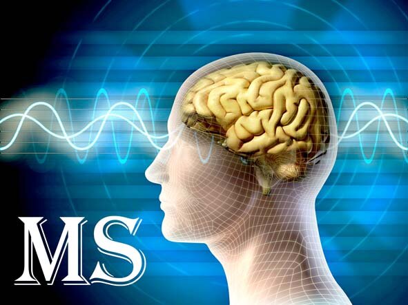 تایید داروی جدید برای بیماران مبتلا به ام اس