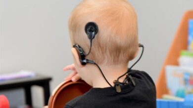 تولد روزانه 12نوزاد کم‌شنوا در کشور/کاشت رایگان حلزون شنوایی