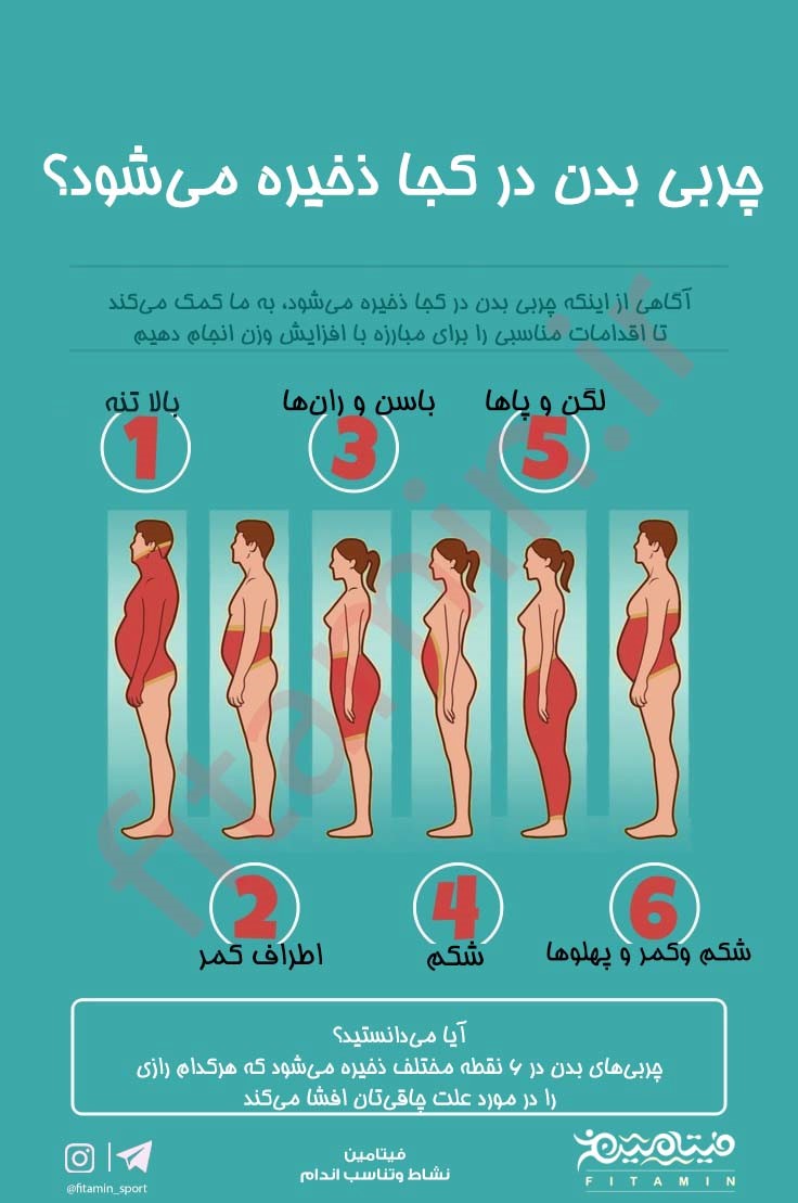 تجمع چربی در ران 