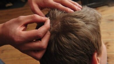 بروز سالانه 700000مورد ابتلا به &quot;شپش&quot; در کشور/راه‌های انتقال