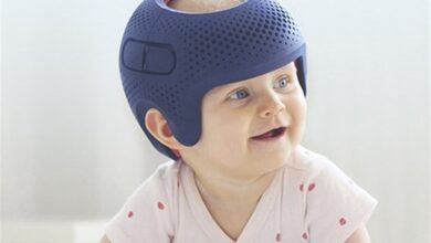 موفقیت ایران در تولید کلاه درمان لهیدگی جمجمه نوزدان