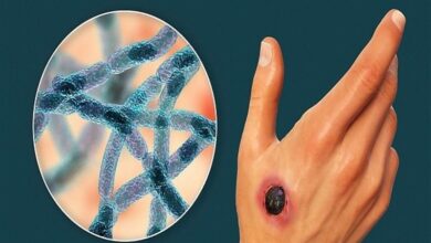 وضعیت بروز &quot;سیاه زخم&quot; در کشور/ راه‌های انتقال بیماری