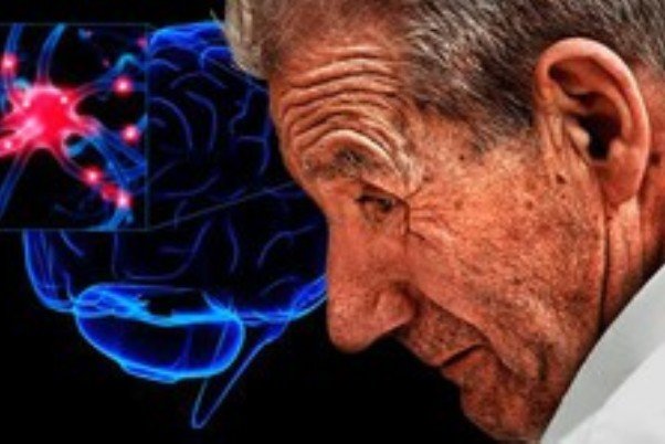 این پروتئین باعث افزایش پارکینسون می شود - خبرگزاری مهر ایران و جهان