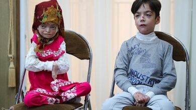 بی توجهی بنیاد بیماری‌های خاص به بیماران&quot;ای‌بی&quot; و مرگ150 نفر