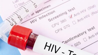 تغییر الگوی انتقال ایدز / HIV از چه راه‌هایی منتقل نمی‌شود؟