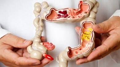 راهکارهای خانگی و ساده برای پیشگیری و درمان یبوست