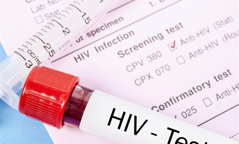 شناسایی 24760 بیمارHIV در ایران؛ "روابط جنسی" علت عمده ابتلا