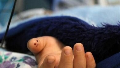 مرگ مشکوک 2کودک تهرانی پس از مصرف ماکارونی