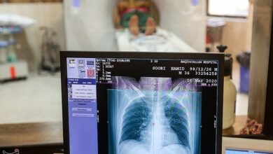 نیمی از تشخیص‌های پزشکی با تصویربرداری انجام می‌شود