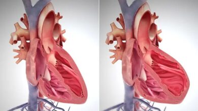 استفاده مداوم از این مسکن ها قلب شما را متوقف می کند