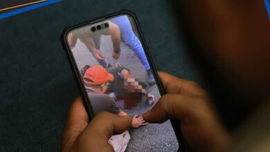 روایتی از پذیرش و درمان مصدومان لبنانی انفجار پیجرها