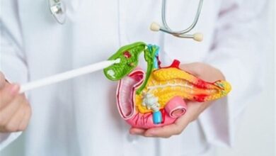 فیلم/ علائم سنگ کیسه صفرا؛ کدام بیماران نیاز به جراحی دارند؟