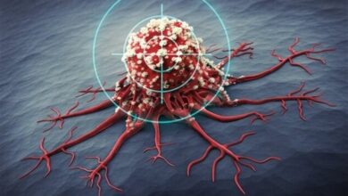 ابتلای سالانه 17000 نفر در کشور به سرطان پستان