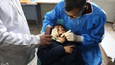 افزایش گرایش نسل جدید به عمل‌های زیبایی دندان