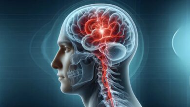 دستورالعمل های مهم برای پیشگیری از سکته مغزی/آمریکایی ها اعلام کردند