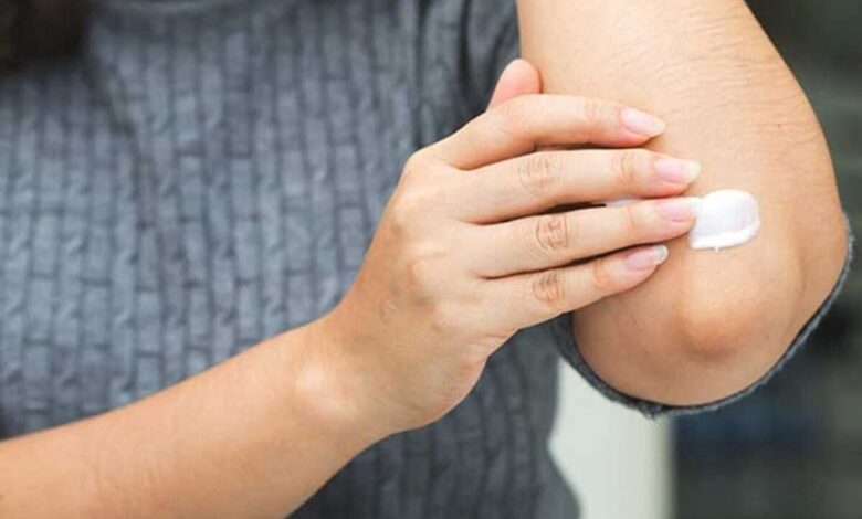 علت اصلی قارچ های پوست را بدانید