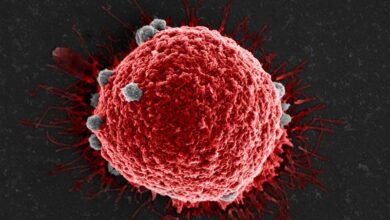 سرطان: علائم ، تشخیص و درمان