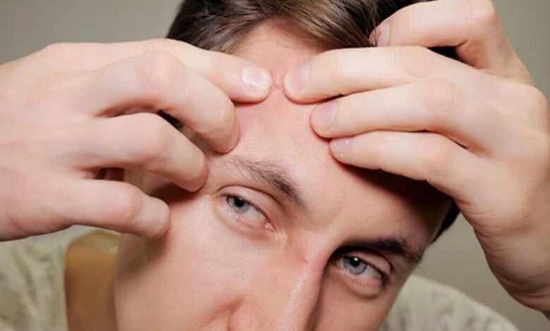 چگونه سلامت پوست را تضمین کنیم؟