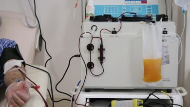 تولید سالانه 580 هزار لیتر پلاسما در کشور