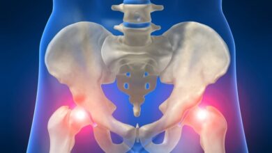 عوامل ایجادکننده اختلالات کف لگن