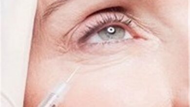 نخ‌ها و کلاژن‌های جذبی باید تحت نظر پزشک استفاده شوند