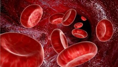 جلوگیری و درمان کم خونی مؤثر ؛ ارمنی از تغذیه مناسب