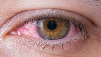 داروی محبوب که باعث سکته مغزی چشم می شود