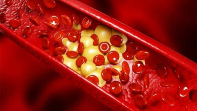 نگاه کنید به | چگونه آزمایش چربی خون خود را تفسیر کنیم؟