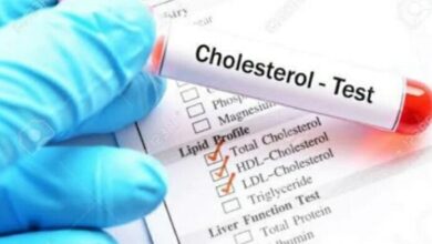 آیا شیر برای کلسترول بالا مفید است یا مضر است؟