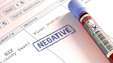 آیا مدل انتقال ویروس HIV تغییر کرده است یا کنترل رایگان بیماری است؟