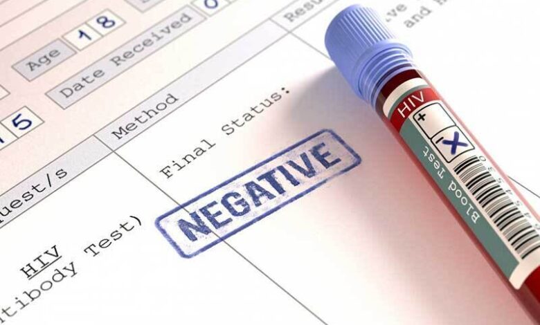 آیا مدل انتقال ویروس HIV تغییر کرده است یا کنترل رایگان بیماری است؟