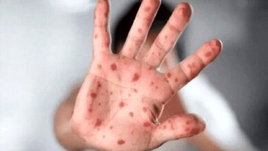 ادامه اضطراری برای این بیماری کشنده