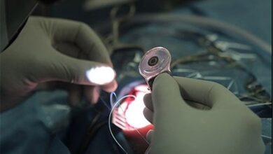 انجام بیش از 20 هزار عمل کاشت حلزون شنوایی در کشور