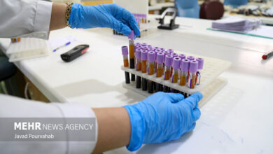 اهمیت آگاهی از اختلالات مخلوط در زنان و دختران - آژانس خبری مهر | اخبار ایرانی و جهانی