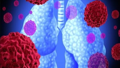 مکمل های مفید برای پیشگیری از سرطان