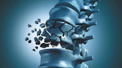 نگاه کنید به | استخوان این گروه از زنان از بقیه خالی تر می شود