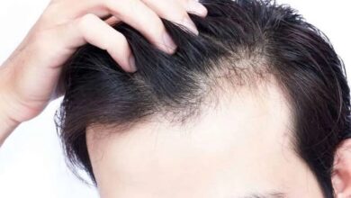 پیشنهادی برای جلوگیری از ریزش مو