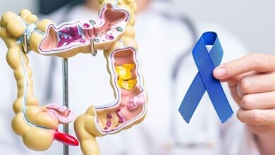 تشخیص زودرس سرطان روده بزرگ برای زنان بسیار مهم است - آژانس خبری مهر | اخبار ایرانی و جهانی