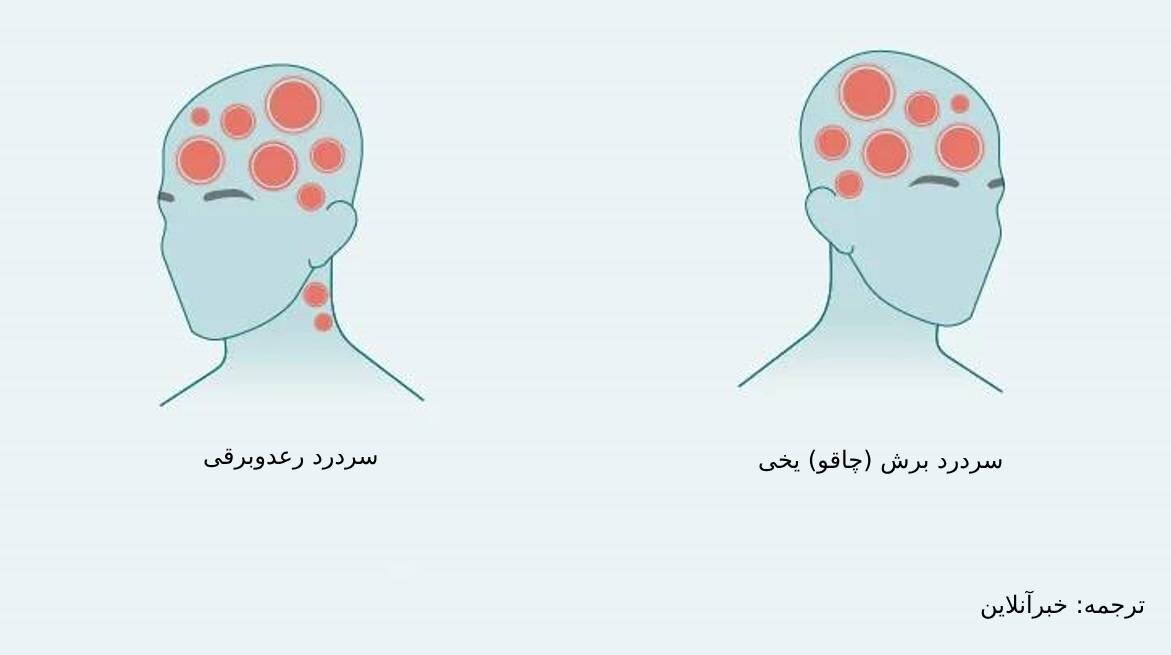 درد در مناطق مختلف سر چیست؟