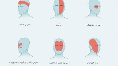 درد در مناطق مختلف سر چیست؟