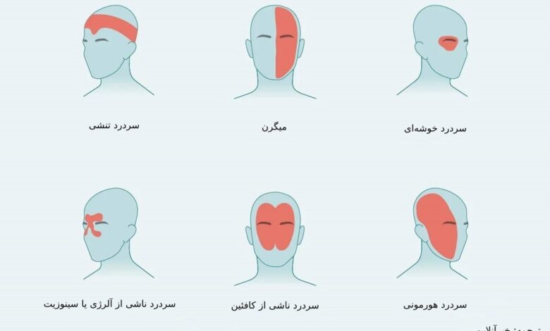 درد در مناطق مختلف سر چیست؟
