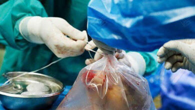 باند قاچاق اندامهای بدن ؛ 2 مرد عراقی و 2 ایرانی/ فروش هر یک از اعضای 1 میلیارد دلار تا 5 میلیارد دلار/ چگونه این داستان پیش رفت؟