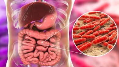سرطان: علائم ، پیشگیری و اهمیت تشخیص زودرس