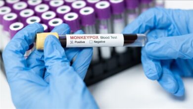 ویروس A Paks قربانی شد