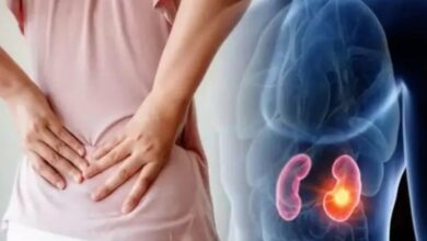 با مصرف این غذاها ، سلامت کلیه ها را تضمین کنید