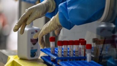 درمان "کوید مزمن" کشف شد